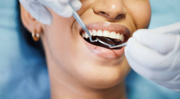 Best Broken Tooth Emergency  in Jackson, LA