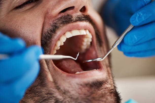 Best Root Canal Emergency Dentist  in Jackson, LA